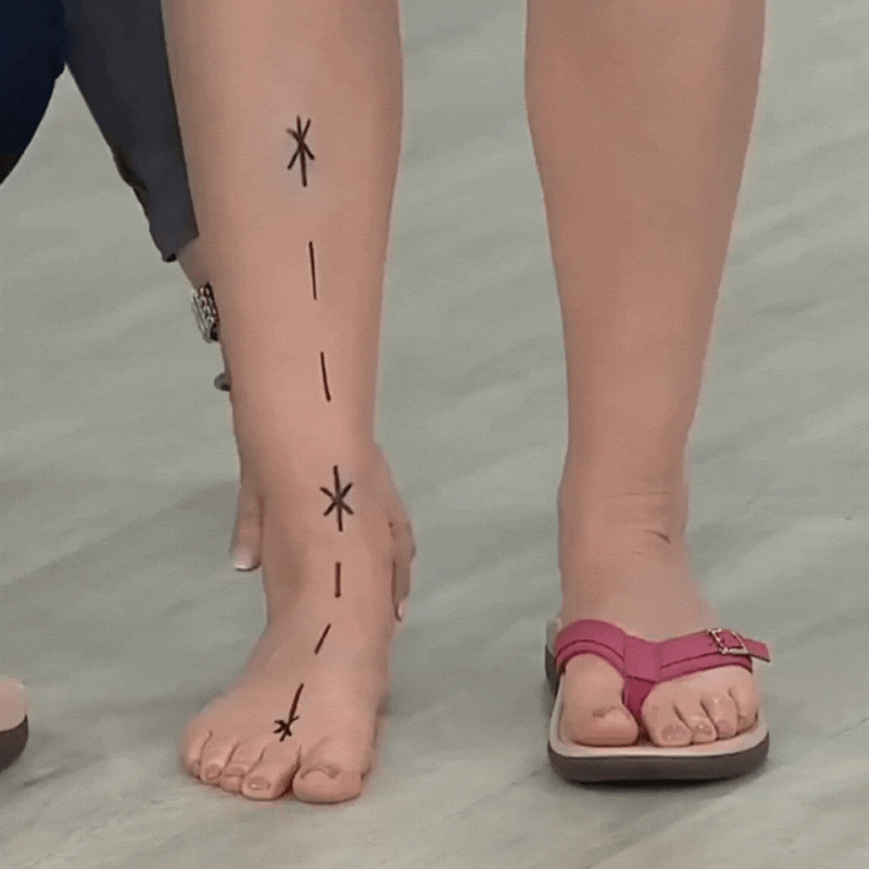 Sophie – Stijlvolle Orthopedische Zomersandalen